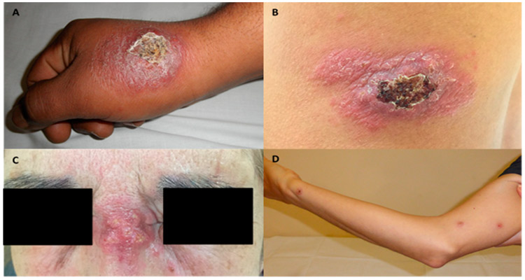 اسکار سالک پوستی