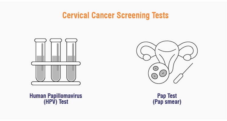 تست HPV DNA و تست پاپ اسمیر (Pap Smear)