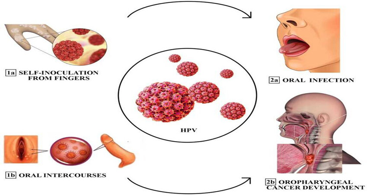 انقتال از طریق رابطه جنسی واژینال، دهانی، مقعدی