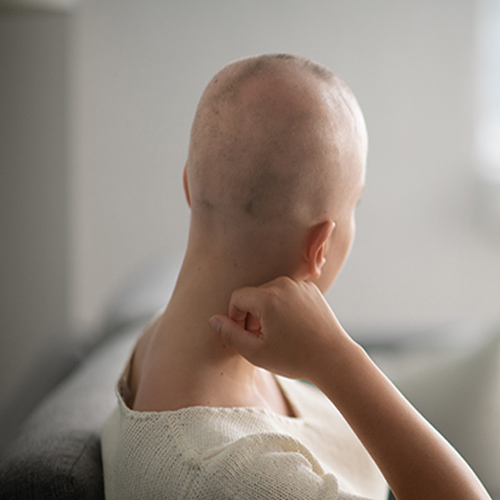 ریزش موی آناژن افلوویوم