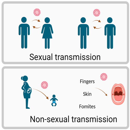راه‌های اصلی انتقال زگیل تناسلی را بشناسید!