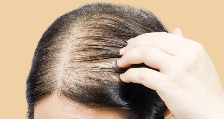 دلایل نازک شدن مو و راه های درمان آن