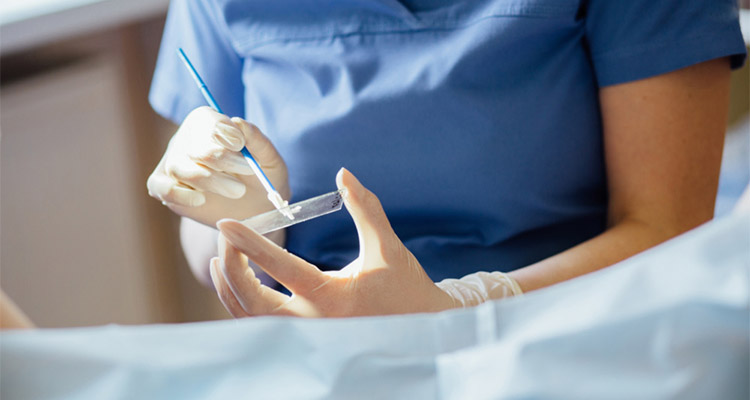 تست پاپ اسمیر