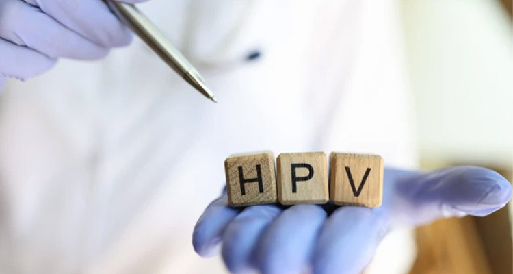 سوالات متداول زگیل تناسلی