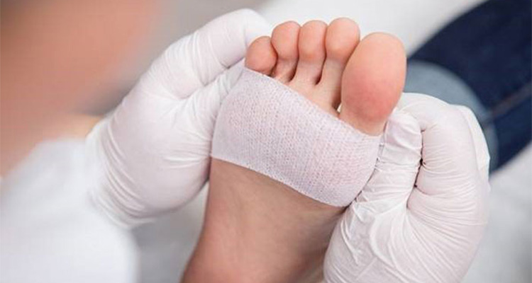 پانسمان زخم پای دیابتی در منزل